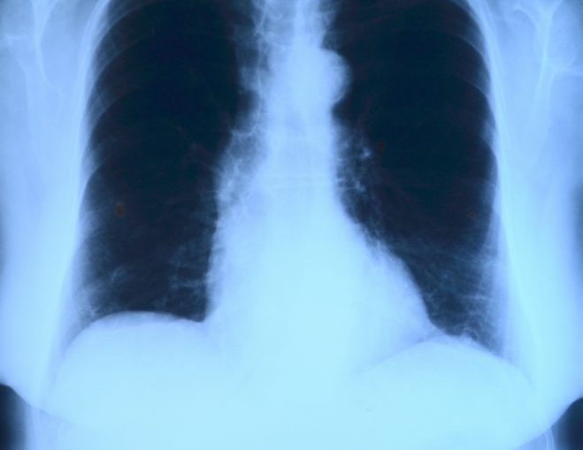 x-ray-image-568241_1920 Die medizinische Fachwelt sowie Hard- und Softwareanbieter müssen ein stärkeres Bewusstsein für Cyberattacken entwickeln. (c) pixabay
